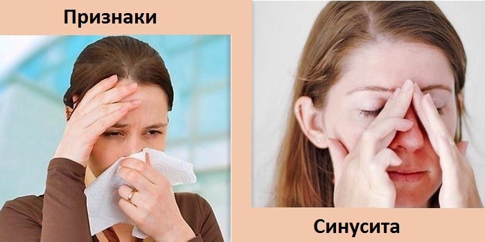 У девушек болит голова и заложен нос
