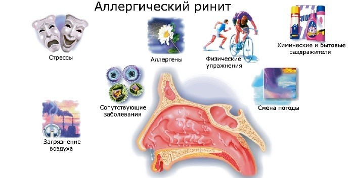 Причины аллергического ринита