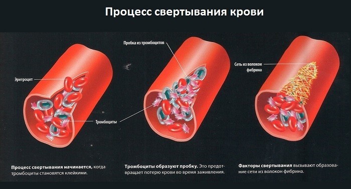 Процесс свертывания крови