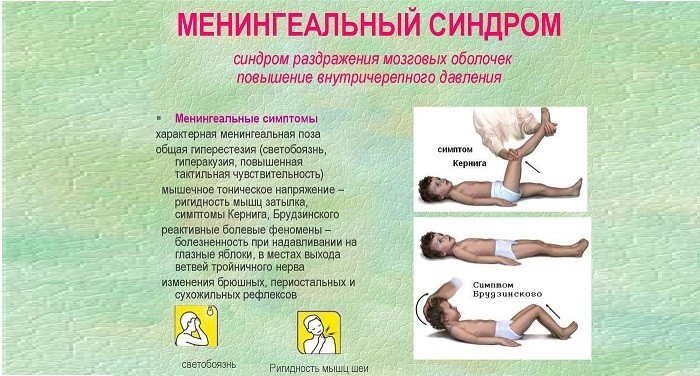 Менингиальные синдромы