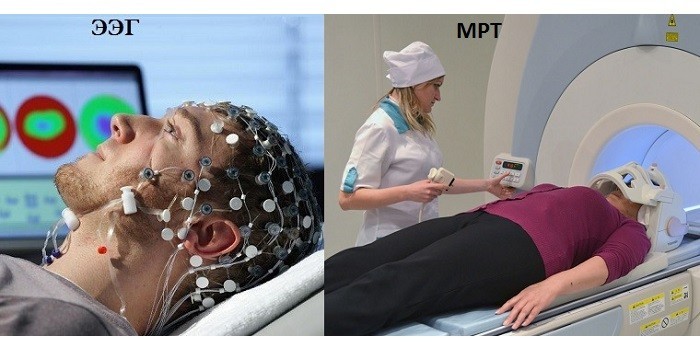 ЭЭГ и МРТ обследования
