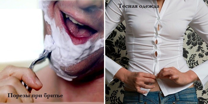 порезы при бритье и тесная одежда