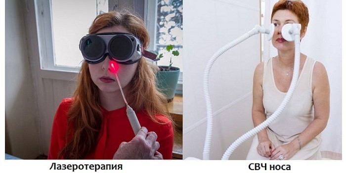 Лазеротерапия и СВЧ носа