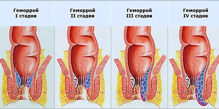 Стадии развития