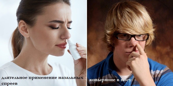 Длительное применение сосудосуживающих и ковыряние в носу