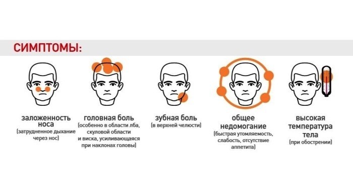Симптомы хронического гайморита