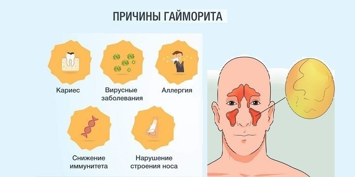 Причины заболевания
