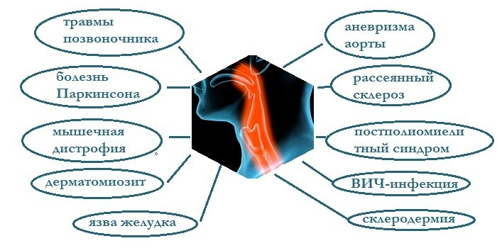 Причины затруднения глотания