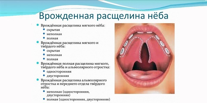 Классификация патологии