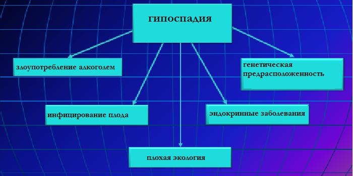 Причины развития гипоспадии