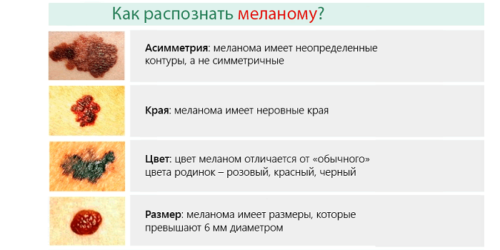 Как распознать заболевание 