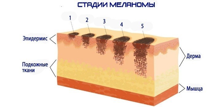 Стадии развития 