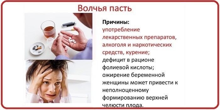 Основные причины аномалии