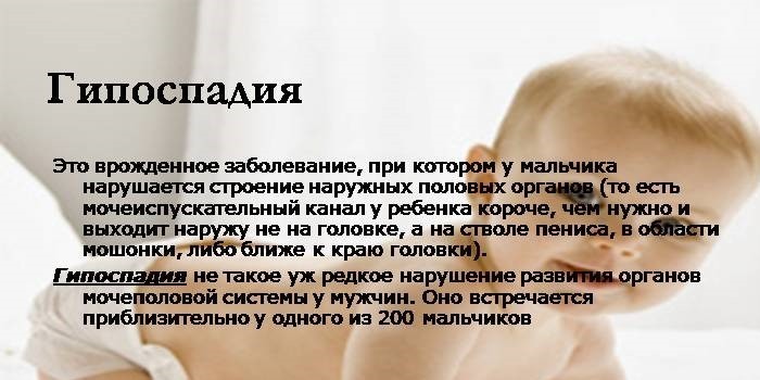 Что такое гипоспадия