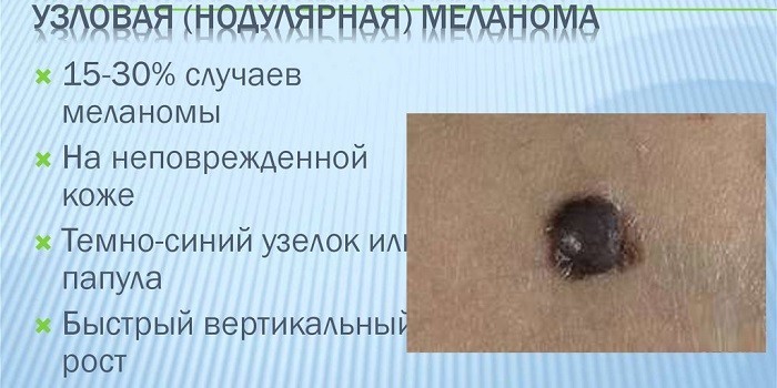 Узловая форма