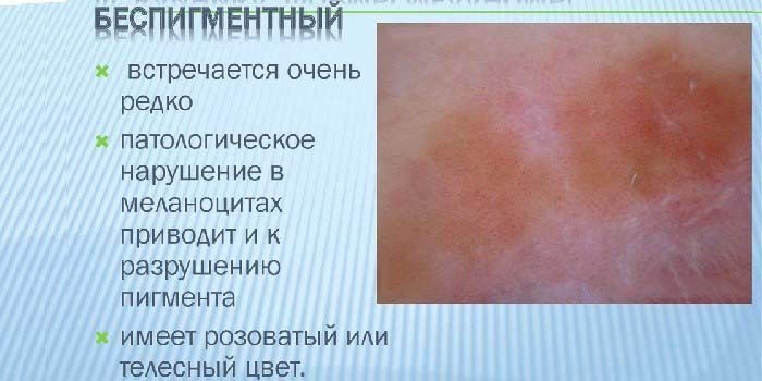 Признаки беспигментной опухоли кожи