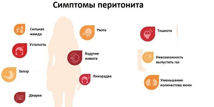 Признаки перитонита