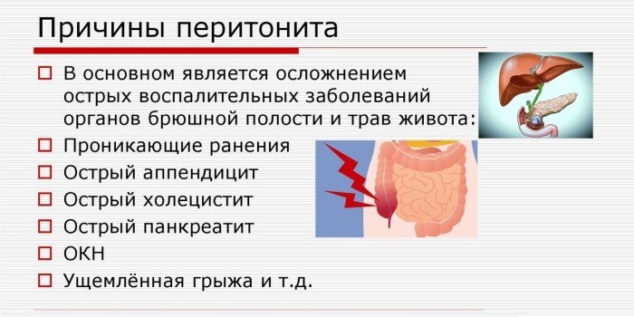 Основные причины