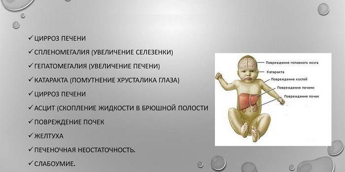 Осложнения заболевания