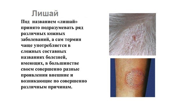 Что такое лишай