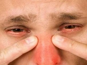 Что такое гайморит у взрослых и детей - причины, симптомы и лечение
