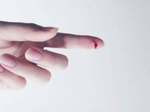 Что такое гемофилия - определение, признаки и причины заболевания, диагностика и способы лечения