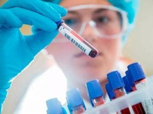 Диагностика вирусных гепатитов по внешним признакам	и составу крови