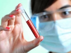 Эритроцитоз у детей и взрослых - причины, симптомы и лечение