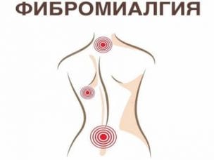 Фибромиалгия – лечение у детей и взрослых медикаментами и народными средствами, диета и профилактика
