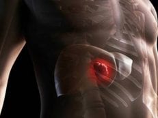 Причины цирроза печени у мужчин — первые признаки, способы терапии, осложнения
