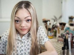 Синдром Олбрайта - описание и причины заболевания, диагностика, способы лечения и возможные осложнения