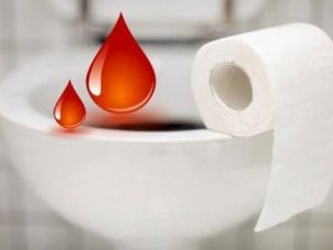 Таблетки при геморрое с кровотечением - лучшие препараты с инструкцией, показаниями и ценой