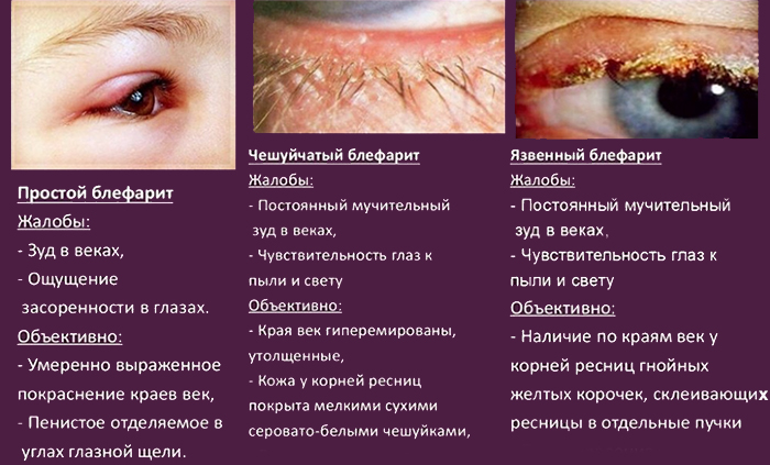 Симптоматика