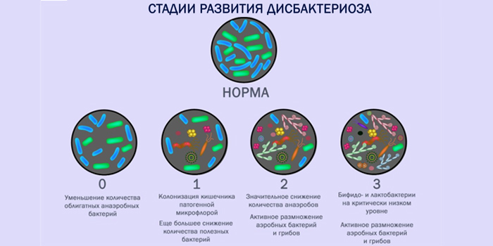 Стадии развития дисбактериоза