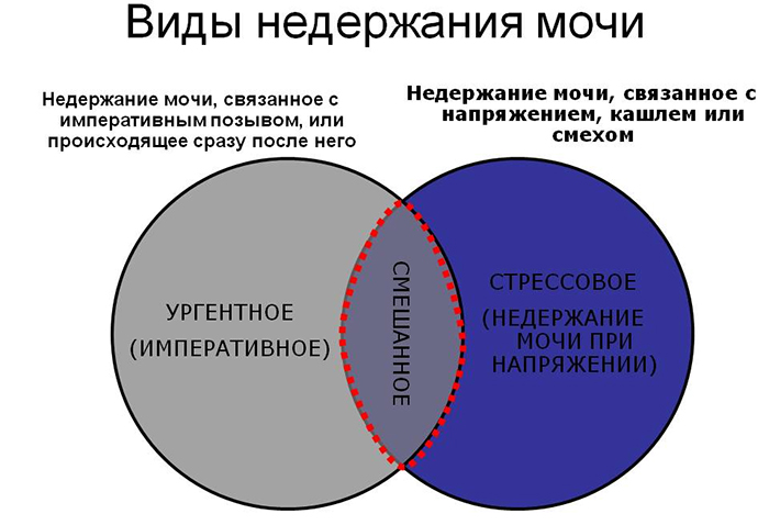 Виды недержания мочи